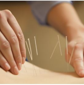 Medicinisk akupunktur physiospain spanien